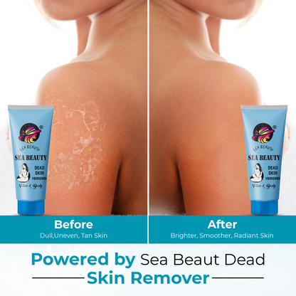 Remove Dead Skin & Get Instant Glow in Just 7 Days ✨